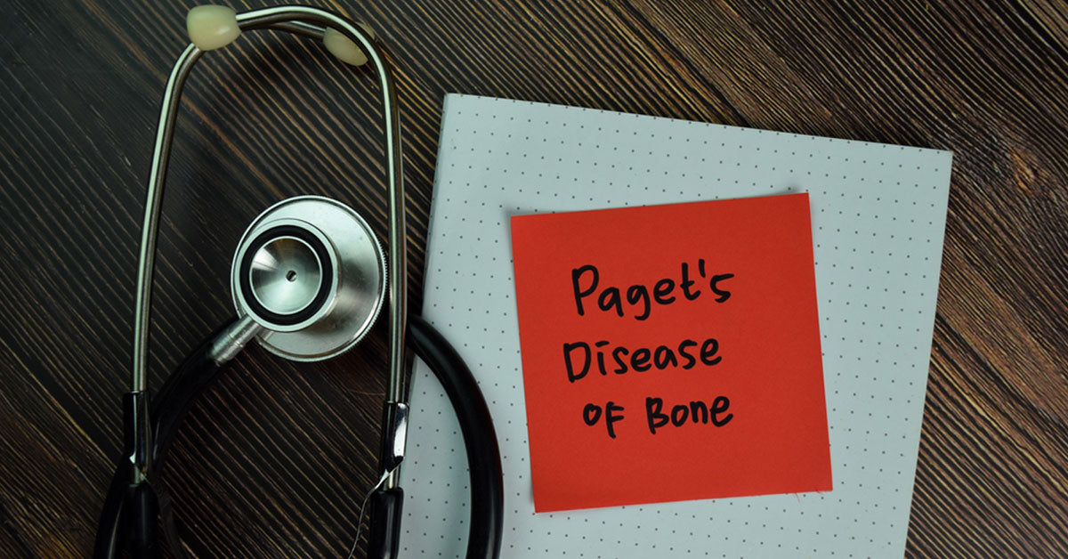 Paget’s Disease of Bone Guide to Being in Control Pharmaxa Labs